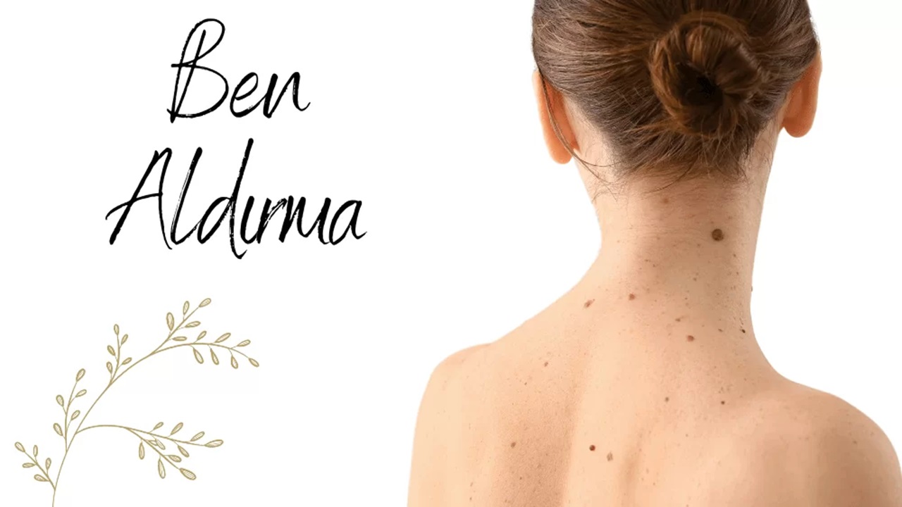 Ben Aldırma ve Kaş Aldırma İşlemleri