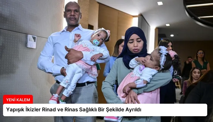 Yapışık İkizler Rinad ve Rinas Sağlıklı Bir Şekilde Ayrıldı