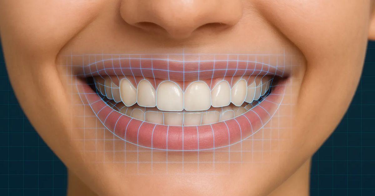 Gülüş Tasarımı Nedir?