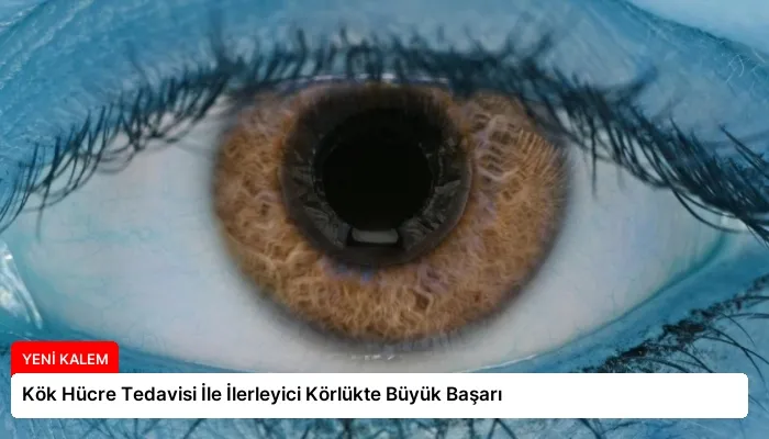 Kök Hücre Tedavisi İle İlerleyici Körlükte Büyük Başarı